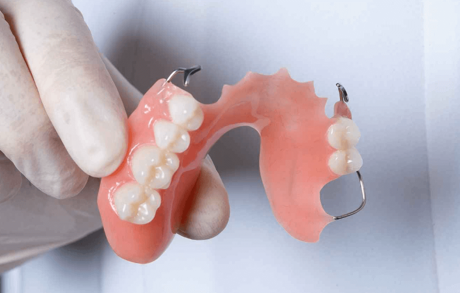 partial dentures