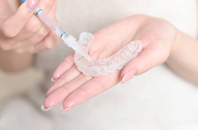 What Are Clear Aligners