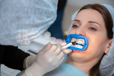 What Are Clear Aligners