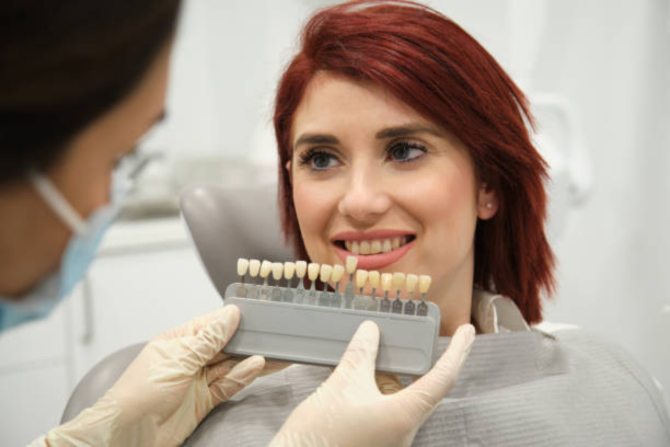 Porcelain-Veneers