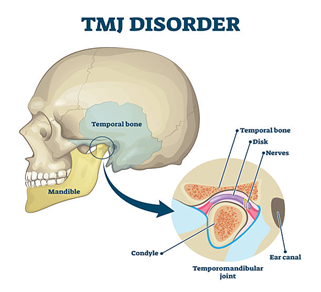 TMJ Analysis