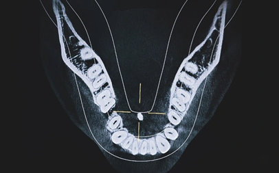 cbct-scan