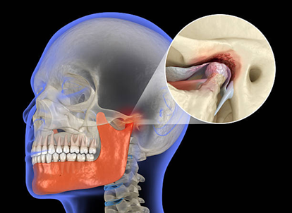 When Should You Consider a CBCT Scan for TMJ