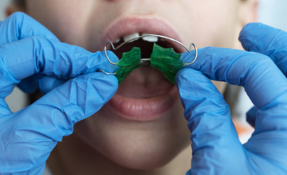 Alternative Treatment Options Before Implants